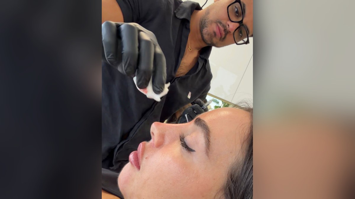 Non-Surgical Rhinoplasty in Miami | Liscano Clinic