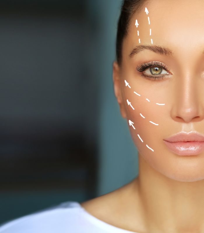Thread Lift Consultation